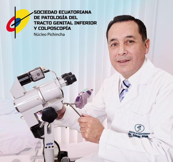 examen-colposcopia-quito